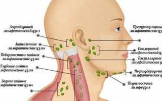 Опухли лимфоузлы за ушами: причины и лечение