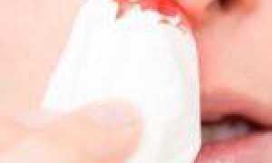 Как вызвать кровь из носа без боли?